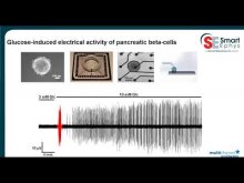 Beta Cell Webinar - Beta Cell Screening